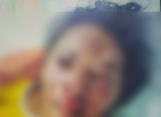 Mulher é espancada e sofre afundamento no crânio após recusar sexo durante festa