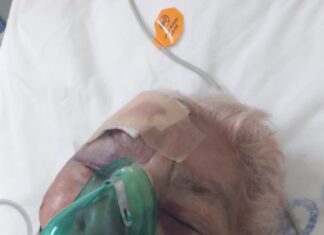 Idosa de 91 anos com pneumonia cai da maca na porta de hospital e fica com ferimentos no rosto: ‘caiu e rolou no chão’ diz bisneto