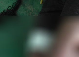Homem é baleado com quatro tiros nas pernas após partir para cima de policiais com faca, diz PM