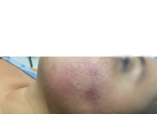 Mulher sofre corte na boca e fica com hematoma no rosto após levar tapa de homem em festa; VÍDEO