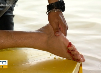 Banhistas são atacados por piranhas durante reportagem em praia de Palmas: ‘Primeira vez que eu vim’