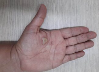 Filho de 10 anos salva mãe que estava sendo eletrocutada enquanto limpava casa: ‘Meu herói’