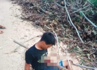 Jovem que teve tronco atravessado no peito em acidente de moto morre após ficar mais de 20 dias internado