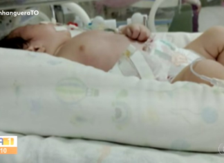 Bebê precisa de cirurgia urgente e mãe diz que está esperando há mais de 20 dias: ‘Aflita e com medo’