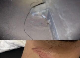 Motociclista e passageira ficam feridos após se enroscarem com fios em rua e caírem de moto