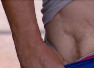 Suspensão de cirurgias eletivas deixa pacientes com medo: ‘Perigoso pegar bactéria’
