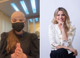 Dermatologistas explicam reações de peeling que causou queimaduras e fez médica usar máscara cobrindo todo rosto