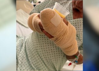 Idoso atacado por pitbull em Palmas vai passar pela quarta cirurgia em dez dias, diz neta