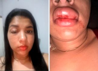 Ex-namorada denuncia vereador por agressão no TO: ‘Abriu a porta e começou a me socar’