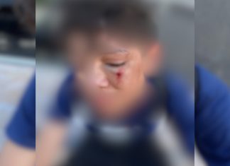 Família denuncia agressão a aluno após caso de bullying em escola no Tocantins