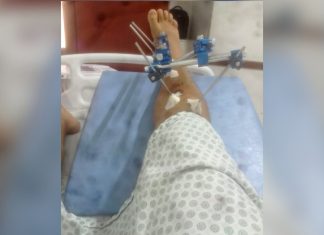 Jovem denuncia ter sido agredido por PMs durante abordagem e dentro de hospital no TO